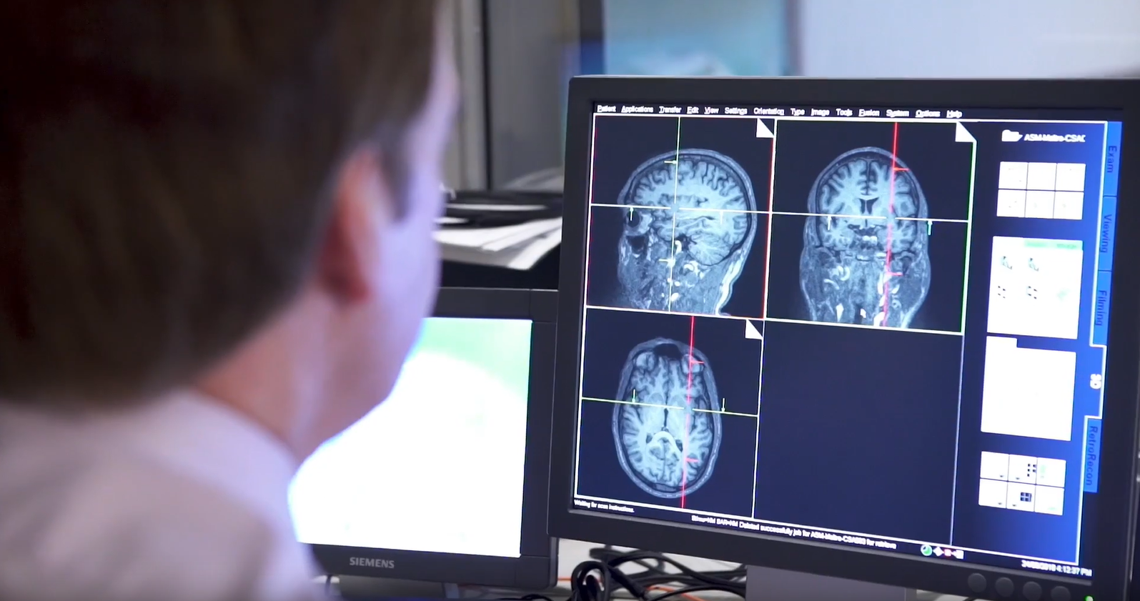 Brain Imaging Centre Research
