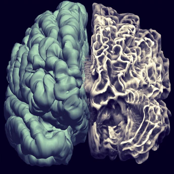 Image du cerveau - Pial intérieur gauche et droit
