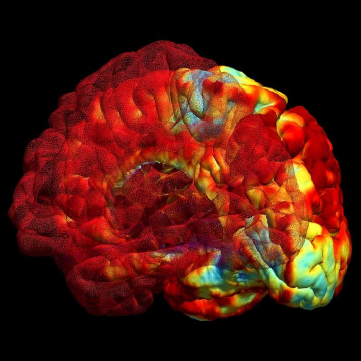 Image du cerveau